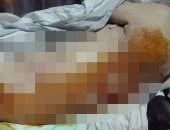بالصور..  تدهور حالة مسن فى مستشفى بالإسكندرية بسبب الاهمال الطبي