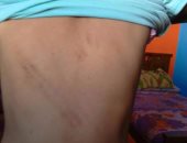 العثور على طفل معاق به أثار تعذيب بالمرج..والمباحث تكثف تحرياتها حول الواقعة