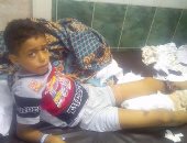 بالصور.. تعفن قدم طفل بسبب الإهمال الطبى بمستشفى كفر الدوار