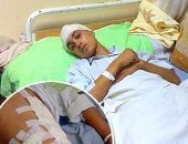 بالصور.. 60 غرزة حصيلة يوم دراسى واحد بالدقهلية.. 3 طلاب يعتدون على آخر بـ"مطواة" داخل المدرسة ويصيبوه بجروح عميقة.. الإدارة تسجل الطالب "غياب" تهربا من المسئولية.. والمجنى عليه: قالوا لى "طلع الفلوس اللى معاك"