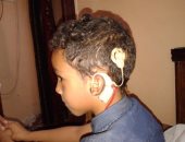 بالصور .."عبد الرحمن" طفل يحتاج لـ90 ألف جنيه ليستعيد قدرته على السمع