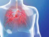 أمراض القلب والروماتيزم تسبب ارتفاع ضغط الدم الرئوى