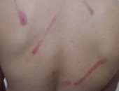 بلاغ يتهم مدرس بالتعدى بالضرب المبرح على طالب بمعهد أزهري في شبين القناطر 