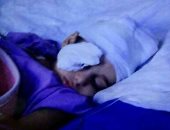 والد الطفل المصاب بطلقة نارية بعد استخراجها من أنف نجله: معجزة طبية وإلهية
