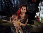 صور وأرقام فى اليوم العالمى للطفل تحكى ألم الجوع لأطفال العالم