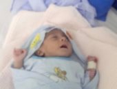 صور.. 50 ألف جنيه تنقذ قلب طفل حديث الولادة بالإسكندرية