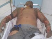 ‎تجديد حبس المتهم بحرق شاب معاق انتقاما منه فى الشرقية