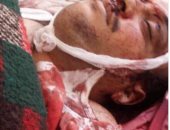 تداول صور الأمين العام المساعد لحزب المؤتمر الشعبى فى اليمن بعد مقتله