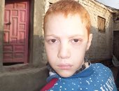 فيديو وصور.. مأساة طفل ولد بدون أطراف فى الإسماعيلية