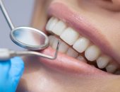 استشارى بعلاج الجذور: استخدام الليزر لعلاج عصب الأسنان يقلل من الألم