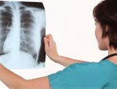 تطوير اختبار جديد للكشف المبكر عن مرض السل