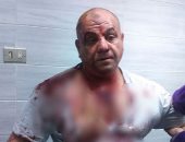 التفاصيل الكاملة للاعتداء على رئيس قطاع الأمن بجامعة بنها بسلاح أبيض