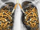 سرطان الرئة له خيارات جراحية منها استئصالها والحياة بدون واحدة