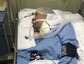 مأساة مريض توفى إكلينيكيا بعد جراحة بالنخاع الشوكى.. والصحة: نبحث الحالة