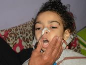صور.. "جوشر" مرض ينهش جسد الطفل محمد ووالده ينتظر رد وزارة الصحة