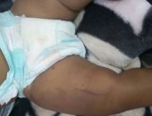 صور.. "جحود الآباء" يصل ذروته.. وصلة تعذيب لرضيع من أبيه بـ"شبشب الحمام" لكثرة بكائه.. الأم: عُدت من العمل فوجدت طفلى لا ينطق.. التحقيقات تكشف: المتهم دائم الاعتداء على الطفل.. والنيابة تقرر حبسه