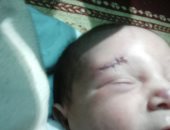 صور.. قارئة تشكو إهمال مستشفى الجلاء.. وتؤكد: شوهوا الطفل عند الولادة