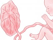 قصور وظائف المشيمة .. مشكلة تكتشف بأشعة الدوبلر وتهدد حياة الجنين