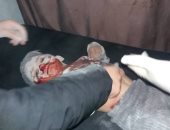 صور.. متحدث كردى: حرس الحدود التركى استهدف مدنيين سوريين بقذيفة هاون