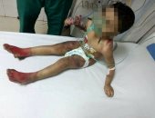 القبض على ربة منزل عذبت طفلها وحرقت جسده بمساعدة زوجها فى كفر الشيخ