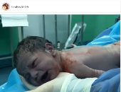 ملكة جمال سوريا تنشر فيديو ولادة قيصيرية على إنستجرام