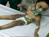 التضامن: اتخاذ الإجراءات القانونية ضد الأسرة فى واقعة تعذيب طفل كفر الشيخ