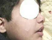 طالب يفقأ عين زميله بقلم رصاص بإحدى مدارس بنها.. والتعليم تحقق فى الواقعة