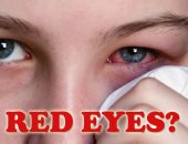 ماذا تفعل عند التعرض لإصابة أو حادث فى العين؟.. وزارة الصحة توضح