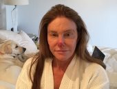 كاتلين جينر تفاجئ متابعيها بصورة تظهر تشوهات دموية فى أنفها