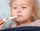 عدوى فيروسية بالفم واليدين والقدم.. مرض شائع يصيب الأطفال خلال هذه الفترة