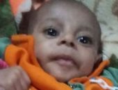 استجابة لصحافة المواطن.. "الصحة" عن طفل الفيوم: سيتم تحويله لمستشفى أطفال مصر