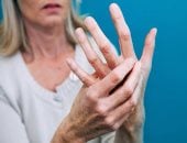 أعراض الروماتيزم تورم الأصابع والتهاب المفاصل