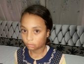صور.. الطفلة تيسير بالشرقية تعانى من أزمة نفسية بعد تعرضها لحريق بنزين 