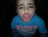 صور.. أب يحرر محضرا ضد صاحب محل بسبب تورم وجه طفله بعد تناول كيس مقرمشات