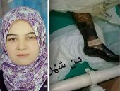 انقذوا نهاد.. مأساة فتاة مهددة ببتر قدميها والعلاج فى الخارج الأمل الوحيد