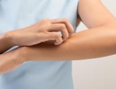 ما سبب الشعور بالحكة القوية من مجرد اللمس؟