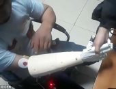 فيديو.. يد روبوتية تساعد مبتورى الأطراف على الإمساك بالأشياء بإشارة العقل