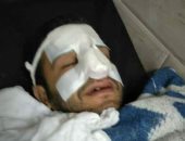 نقابة الأطباء: اعتداء على طبيب بمستشفى الساحل التعليمى وإصابته بكسور فى الأنف