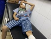 إدارة بلدية المحلة تتكفل بعلاج طفل بعد إصابته داخل النادى