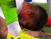 فيديو.. إصابة دموية لجيرو فى تعادل فرنسا وأمريكا 1 - 1 قبل المونديال