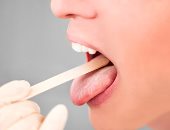 علاج جفاف الفم بطرق عديدة منها تناول بدائل اللعاب