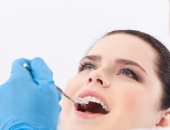 7 نصائح لعلاج تقرحات الفم أبرزها البعد عن التوتر والشيكولاتة والتوابل