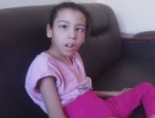 فيديو وصور.. الطفلة منة ضحية إهمال طبى تحتاج 6 عمليات لتستطيع "المشى"