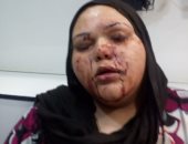 عاطل يصيب شقيقته بالخرطوش بسبب خلافات على الميراث فى الشرقية