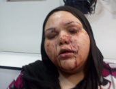 حبس المتهم بإصابة شقيقته بالخرطوش لخلافات على الميراث بالشرقية