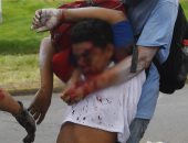  صور.. مقتل متظاهر وإصابة 11 آخرين خلال مظاهرات حاشدة فى نيكاراجوا 