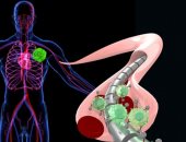 ابتكار سلك مغناطيسى يحل محل اختبارات الدم للكشف عن السرطان