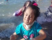 قارئة تطالب بعلاج ابنة شقيقها على نفقة الدولة