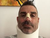 حارس كييفو يسامح رونالدو بعد كسر أنفه.. فيديو