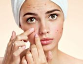 للحفاظ على جمالك وصحتك.. 4 علامات لو ظهرت على بشرتك لازم تروحى للدكتور